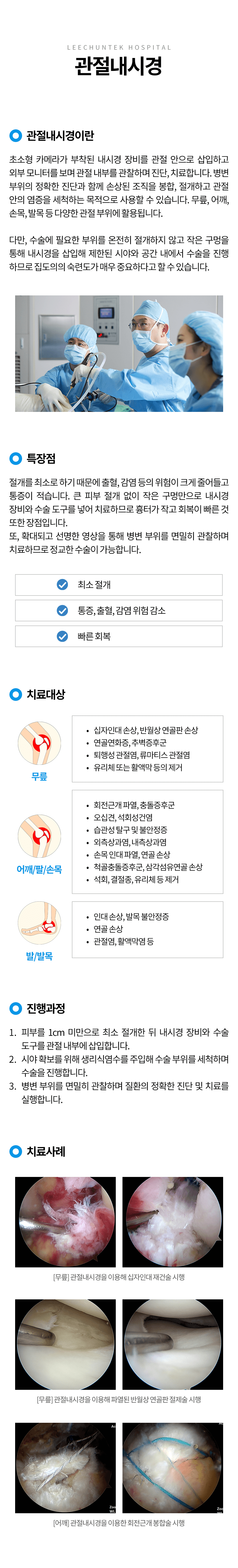 관절내시경