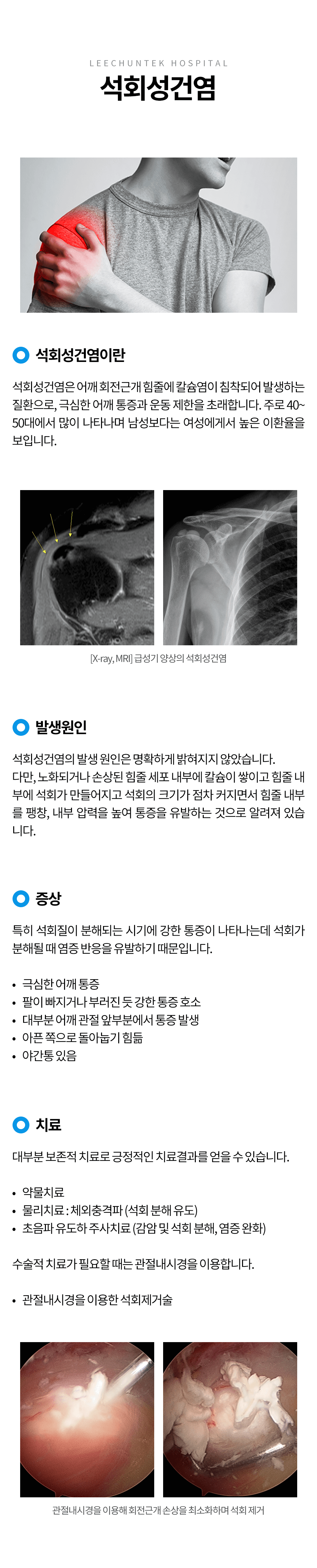석회성건염