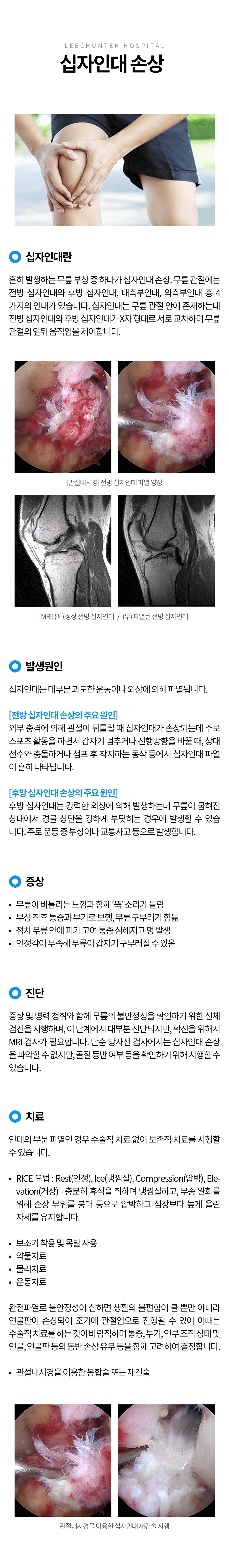십자인대 손상