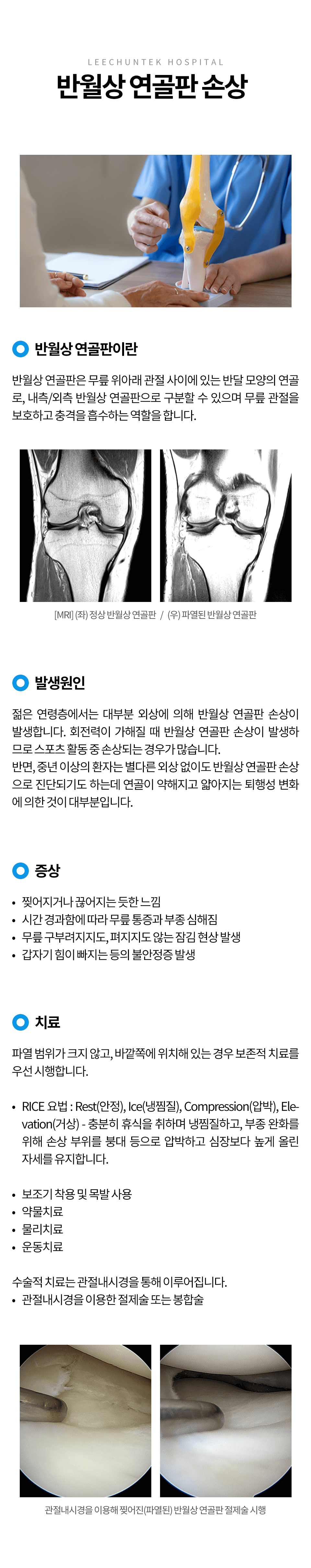 반월상 연골판 손상