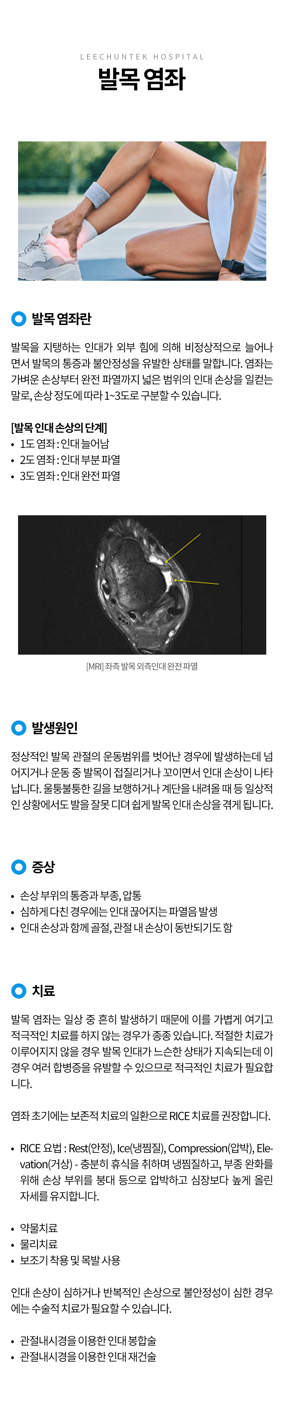발목 염좌