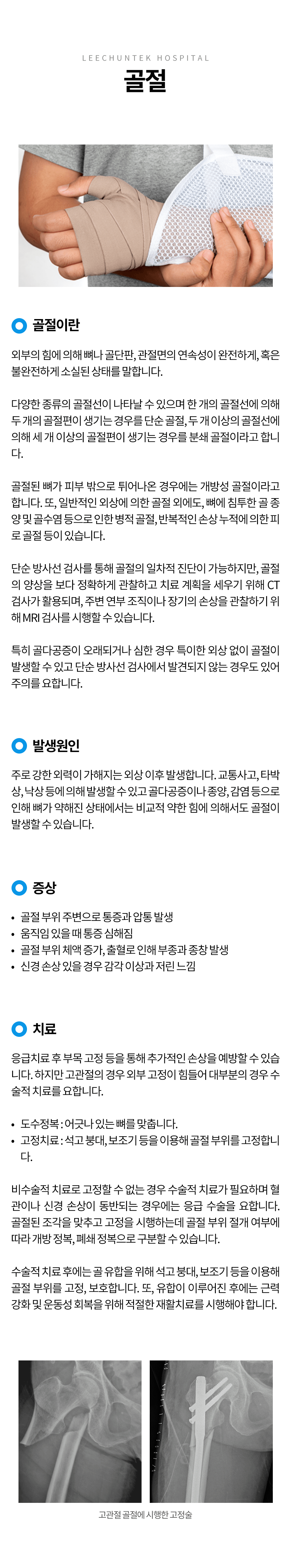 골절